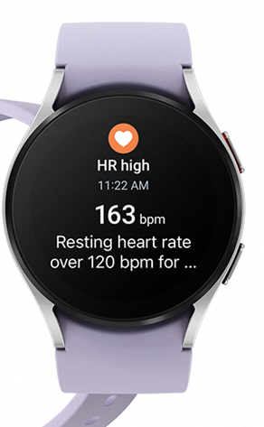 Samsung Galaxy Watch 5  Akıllı Saat 40 MM Siyah